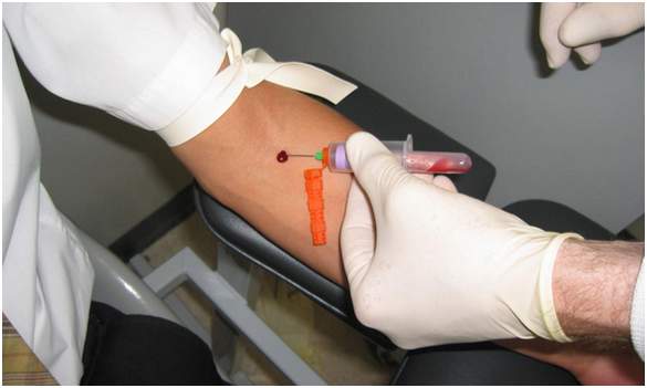 Уровень гемоглобина в крови